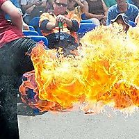 leg burn off